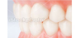 Fix Dentures Perth, WA Karratha, Port Hedland, Osborne Park
